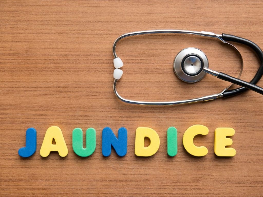 Neonatal Jaundice Variations Causes and Treatment Methods